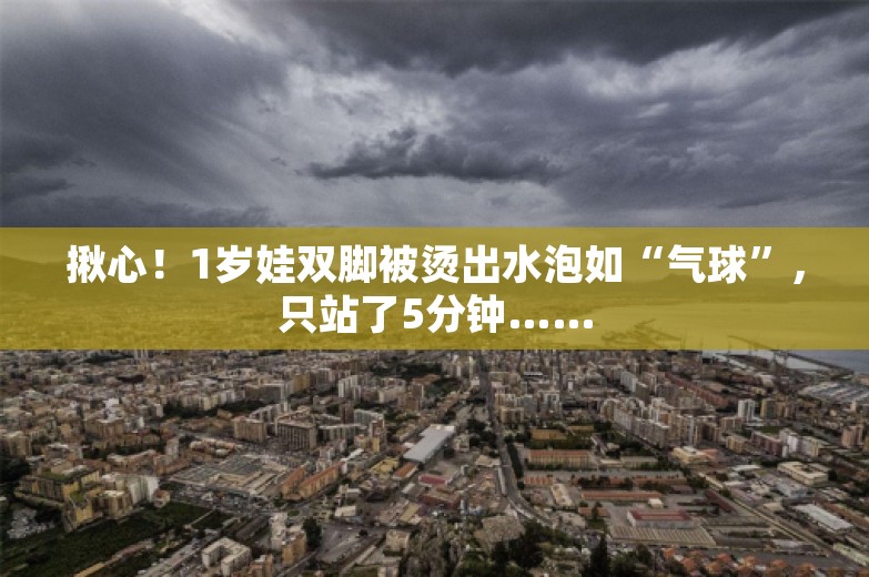 揪心！1岁娃双脚被烫出水泡如“气球”，只站了5分钟……