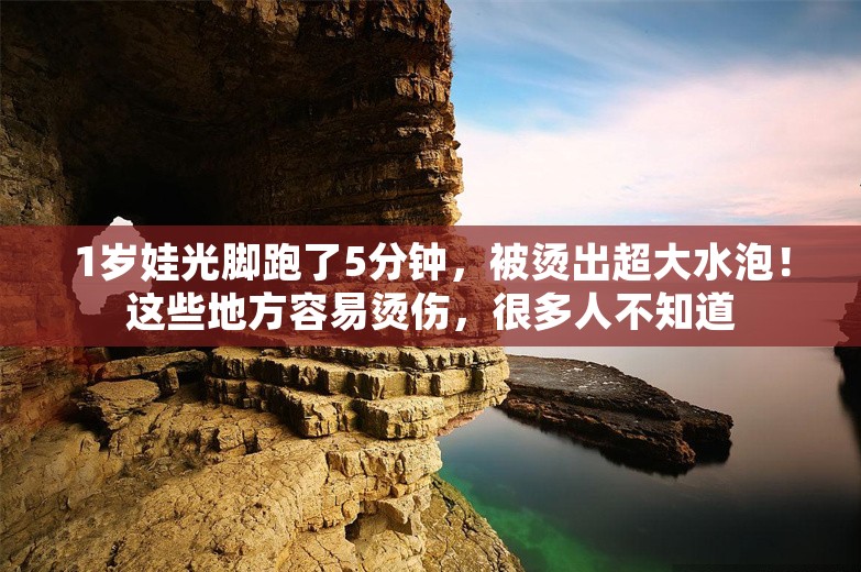 1岁娃光脚跑了5分钟，被烫出超大水泡！这些地方容易烫伤，很多人不知道